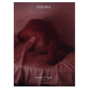 Stigma