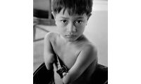 Agent Orange, Collateral Damage in Viet Nam